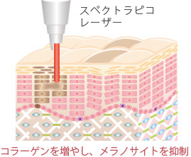 コラーゲンを増やし、メラノサイトを抑制