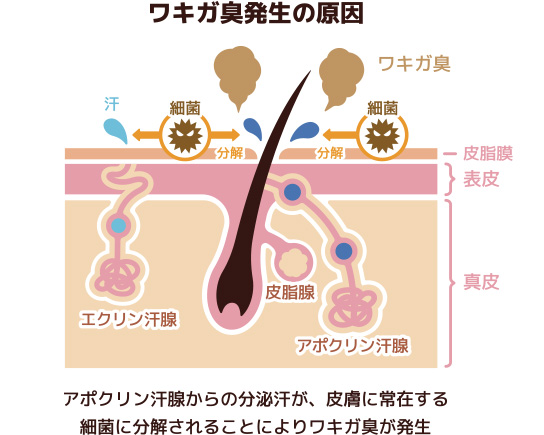 ワキガ臭発生の原因