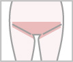Vライン脱毛（ビキニライン）