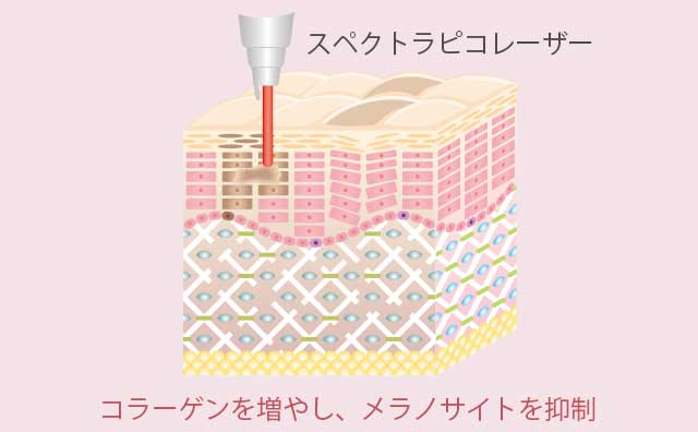 コラーゲンを増やし、メラノサイトを抑制