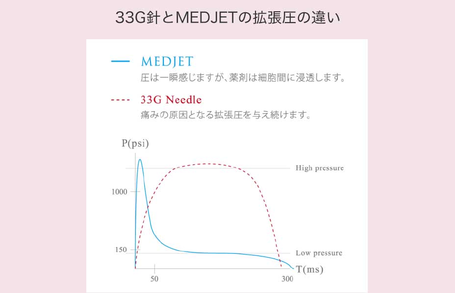 33G針とMEDJETの拡張圧の違い