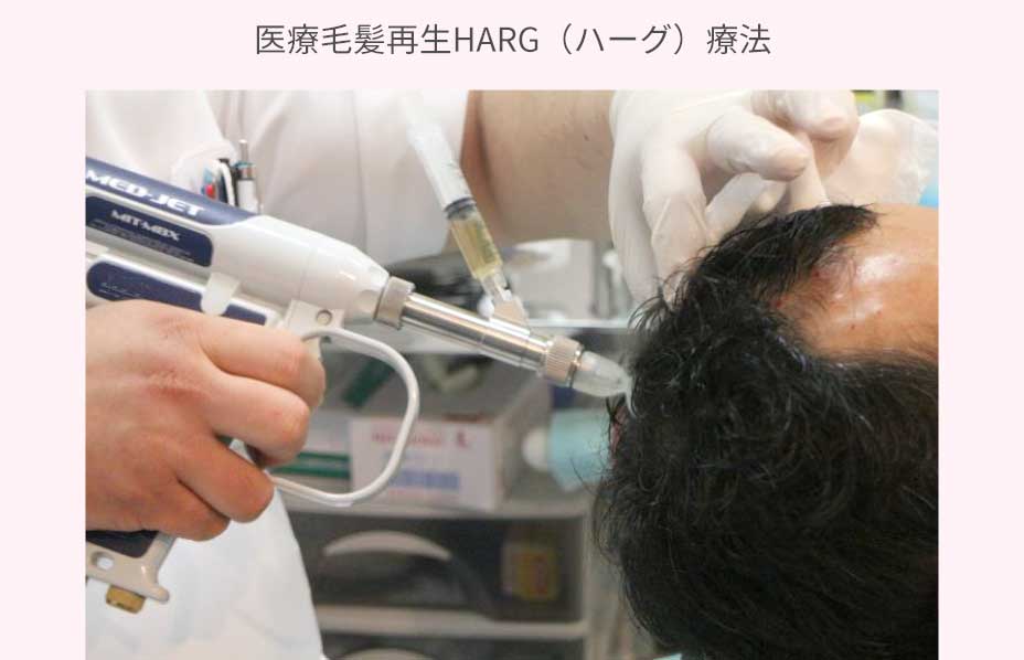 医療毛髪再生HARG（ハーグ）療法