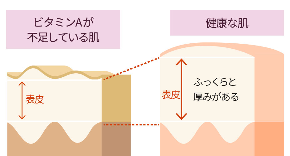 レチノールの肌への効果