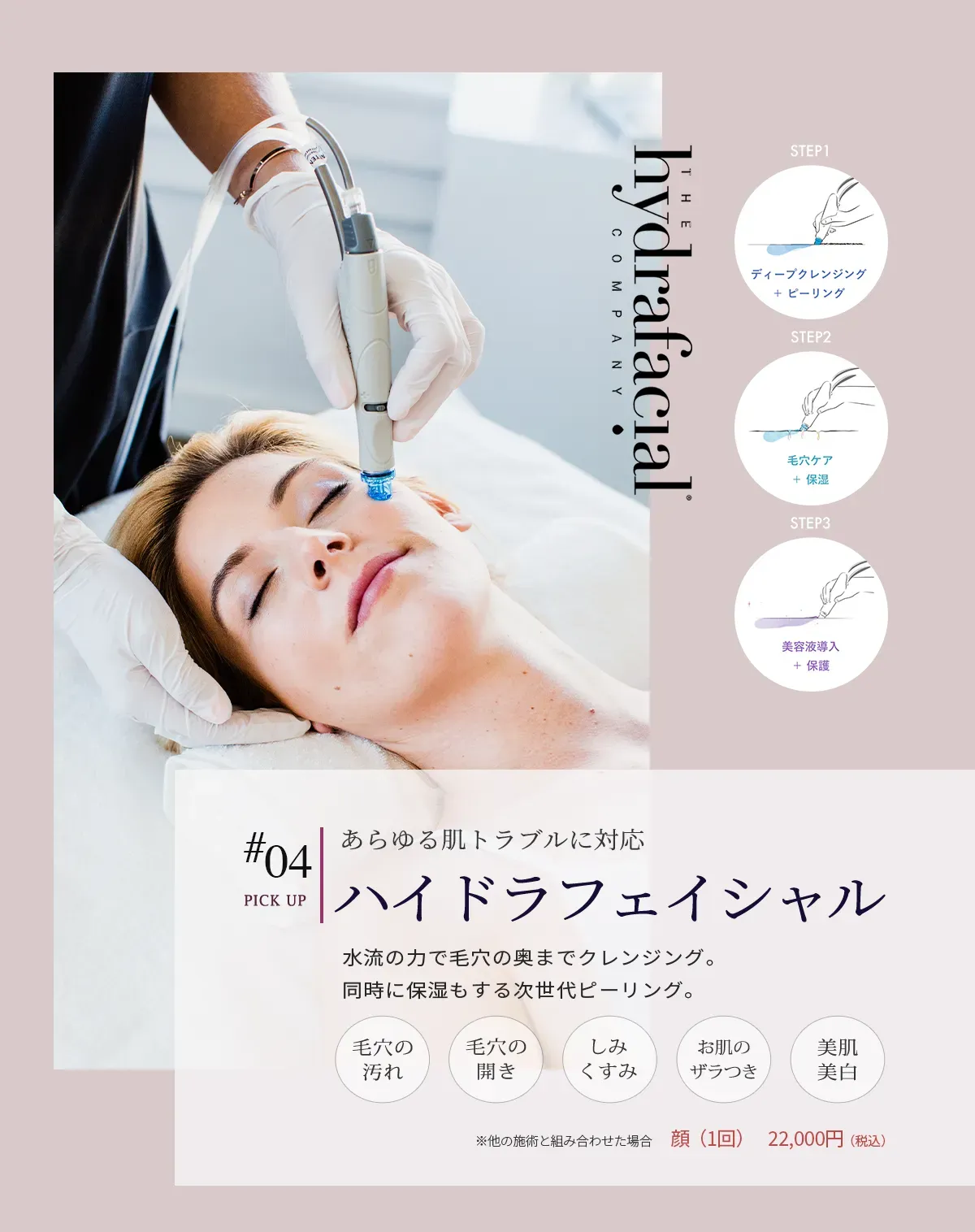 #04あらゆる肌トラブルに対応 ハイドラフェイシャル