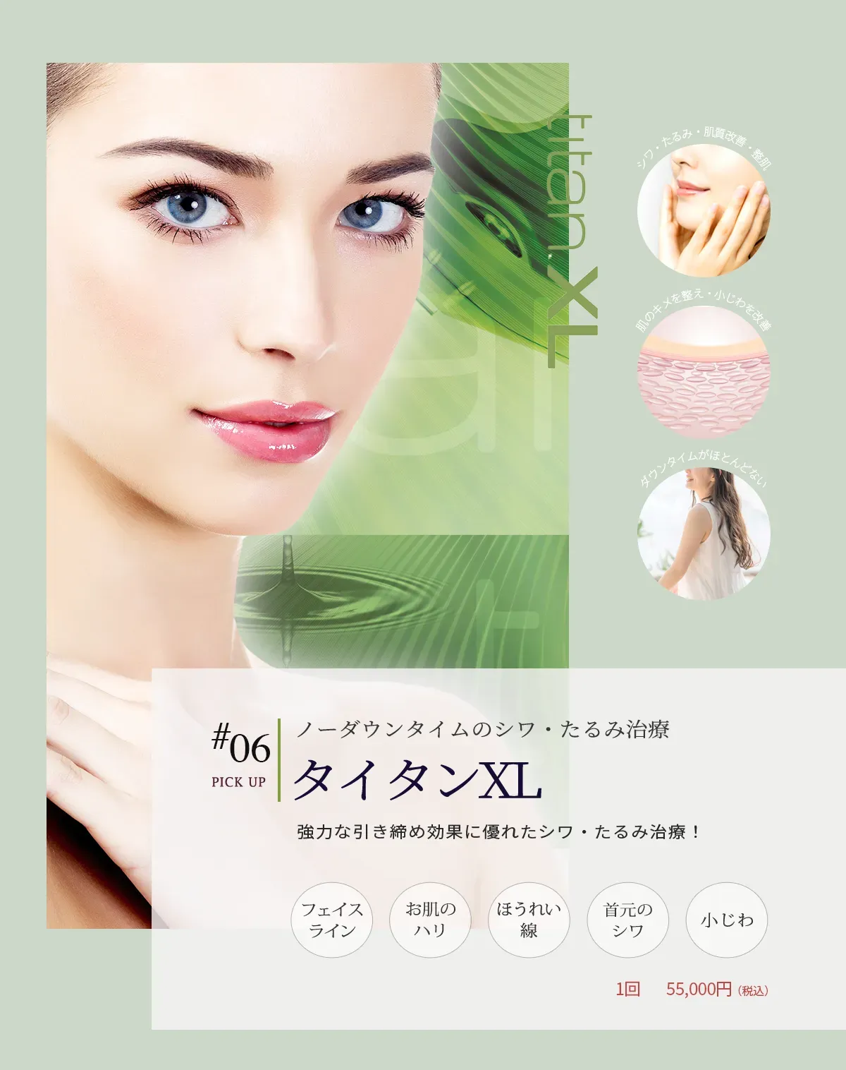 #06ノーダウンタイムのシワ・たるみ治療 タイタンXL